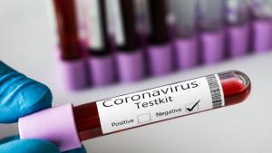 тест коронавирус
