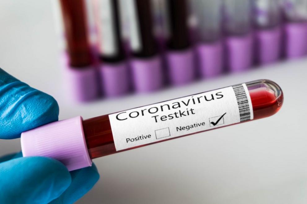Полският президент Анджей Дуда е дал положителен тест за коронавирус,