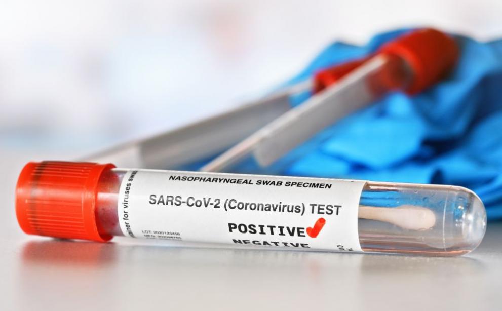 Новите случаи с коронавирус у нас за изтеклото денонощие са