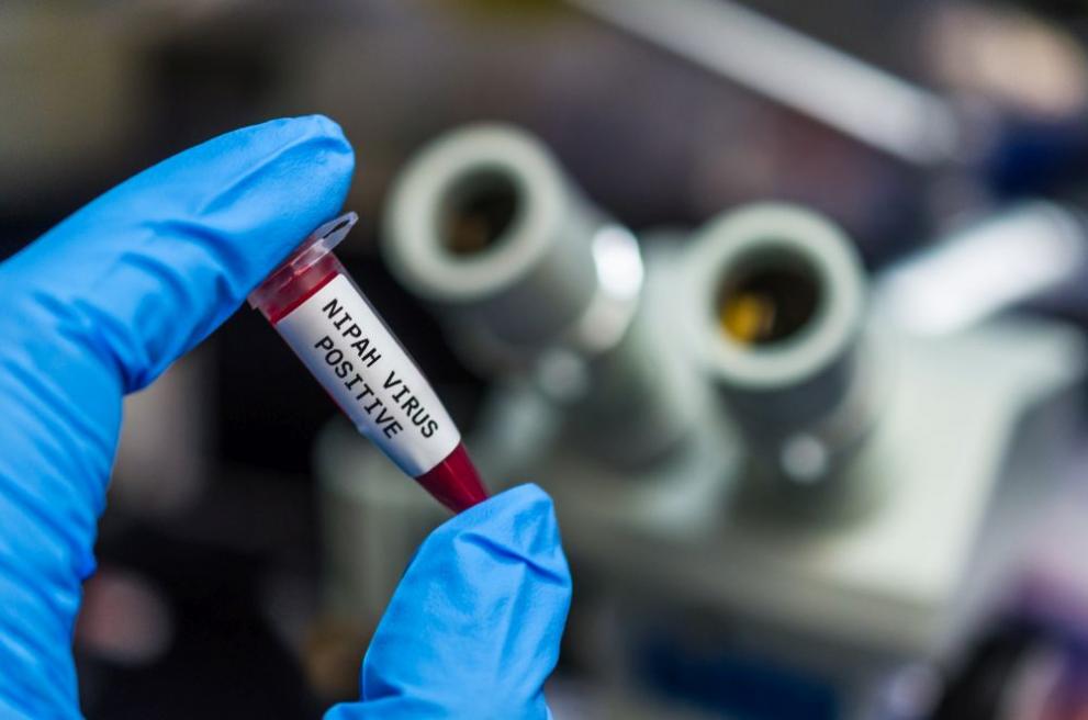 Вирусът Нипах може да причини още по-смъртоносна пандемия от коронавирусната, алармират учени