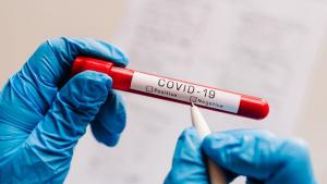 484 случая на COVID 19 са регистрирани в областта през изминалото