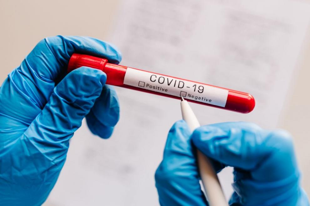 822 случая на COVID-19 са регистрирани в областта, съобщиха от
