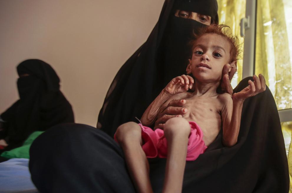 Милиони деца в Йемен за заплашени от гладна смърт