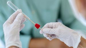 Равен брой заразени и оздравели от коронавирус отчитат здравните власти