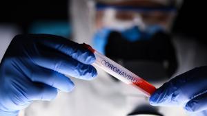 93 нови случая на коронавирус са регистрирани в област Хасково