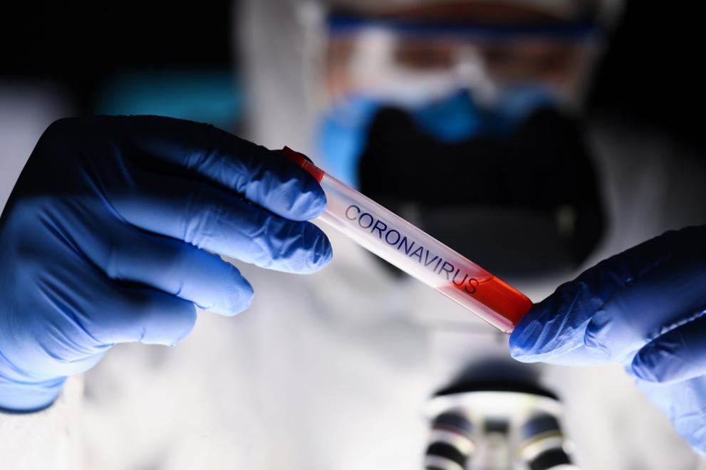 168 нови случая на коронавирус са регистрирани в област Хасково