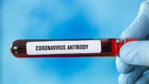 тест антитела коронавирус covid19
