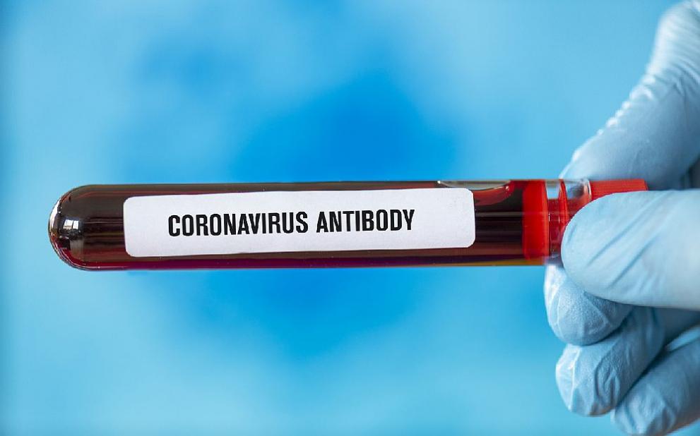 125 нови случая на коронавирус са регистрирани в област Хасково