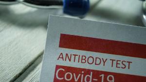 Изработените антителата след преболедуване от COVID 19 могат да циркулират в