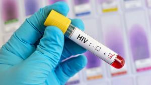 Безплатни и анонимни изследвания за ХИВ СПИН ще се извършват в