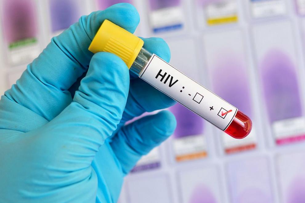 Безплатни и анонимни изследвания за ХИВ/СПИН ще се извършват в