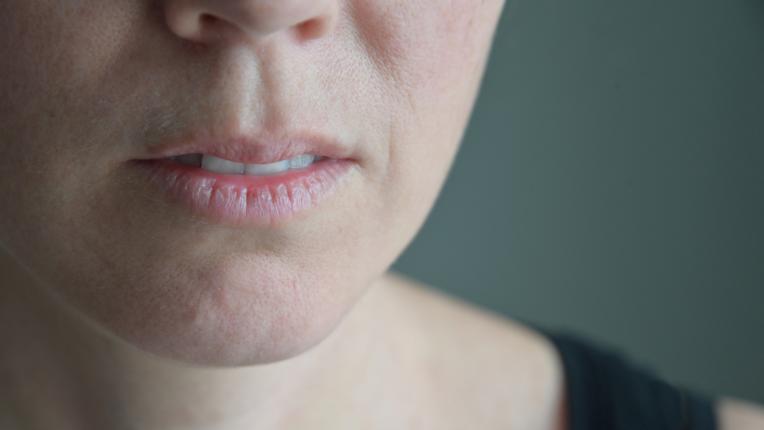 Напукани, парещи, сухи: какво издават устните за здравето ни 