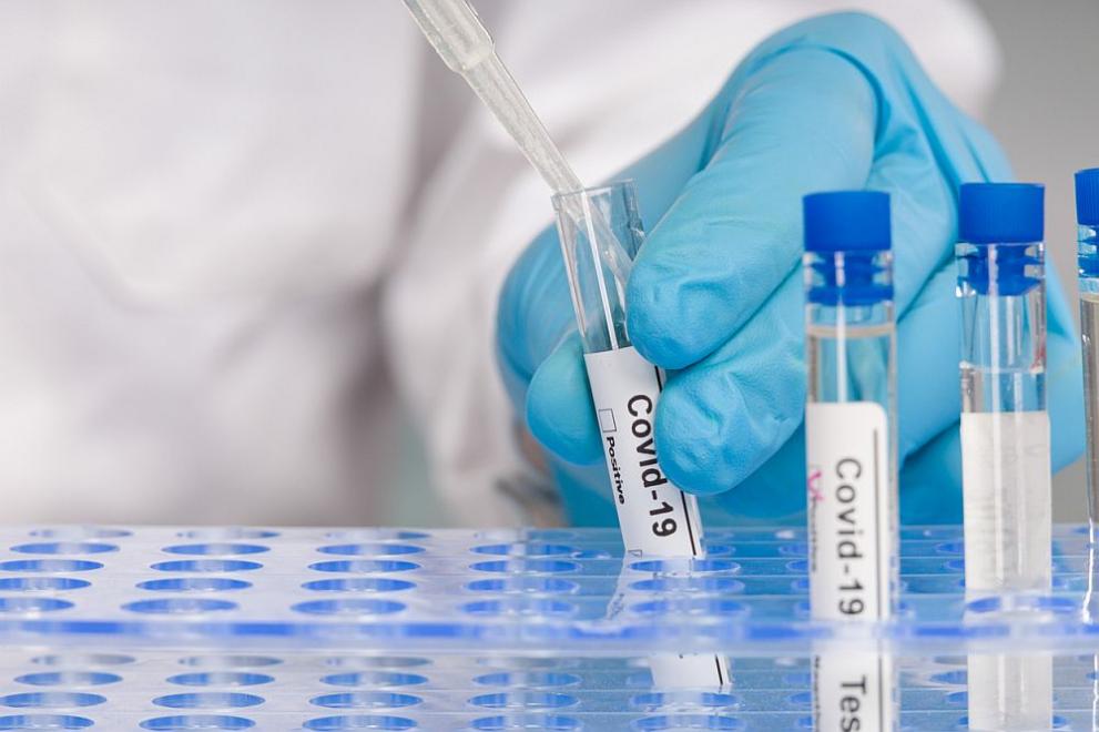 119 нови случая на коронавирус са регистрирани в област Хасково
