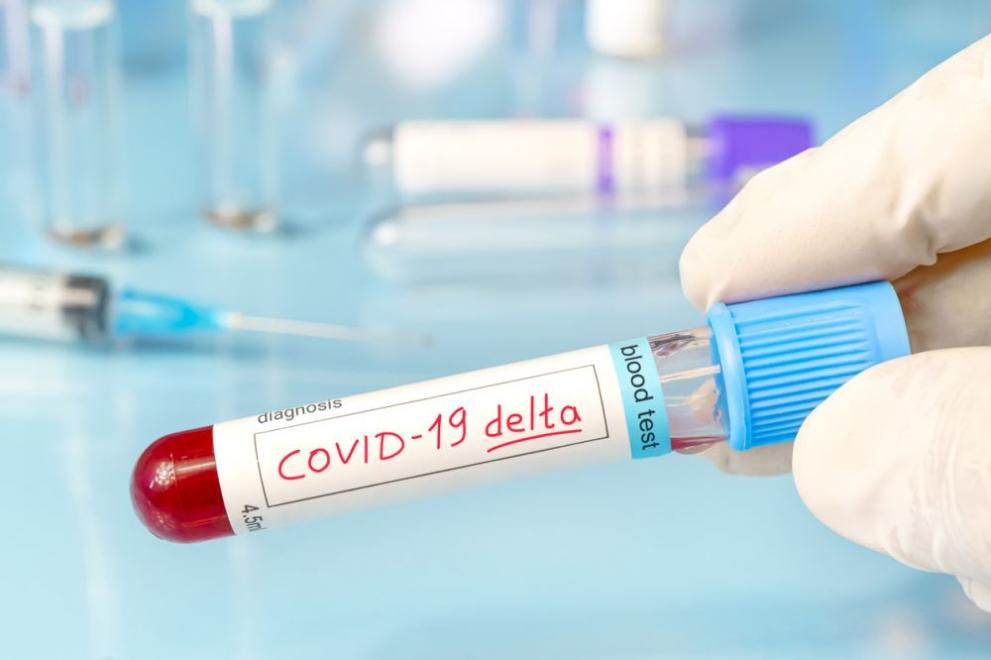 В област Плевен заболеваемостта от COVID-19 е 1027,68 на 100