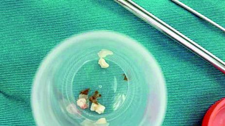 Лекари върнаха дете от гроба