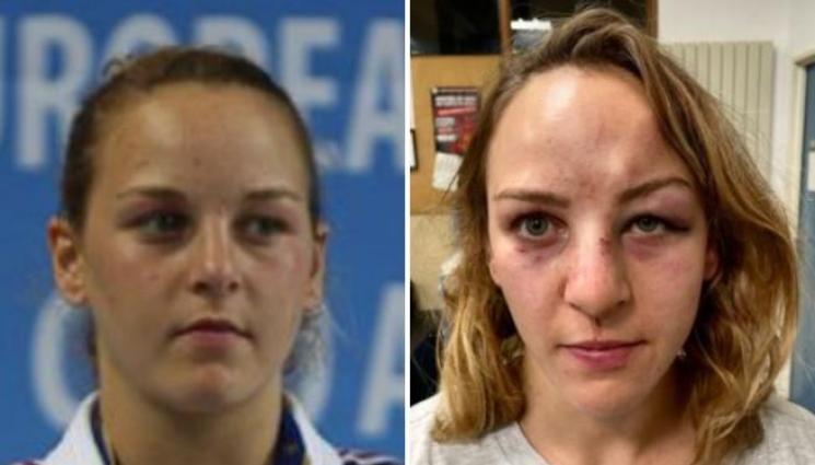 Марго Пино - Шампионка по джудо взриви Франция, обвини треньор в опит за убийство