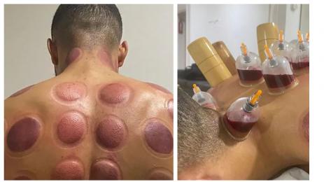 Данжума вендузи Виляреал