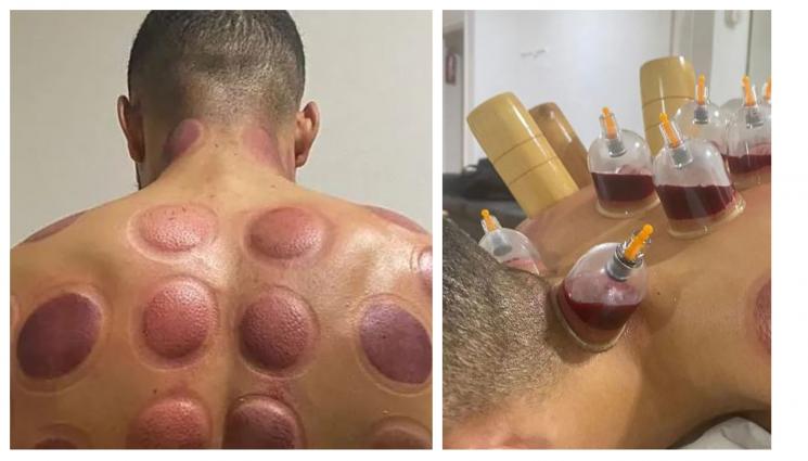 Данжума вендузи Виляреал - Вендузи красят гърба на нападател на 