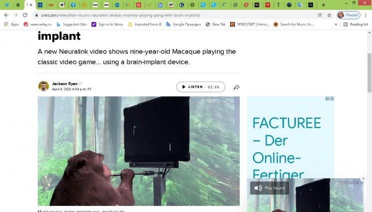 Биоритъм - БИОРИТЪМ: Мъск ще лекува парализа с чип в мозъка