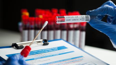 коронавирус