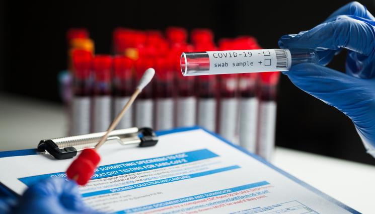 коронавирус - Пореден рекорд: Над 12 000 са новозаразените с COVID-19 у нас