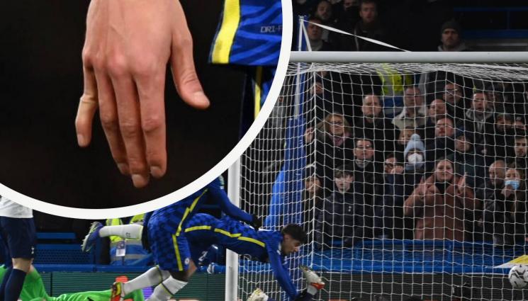 Хаверц Челси Тотнъм гол пръст - От радост счупиха кутрето на голмайстор от Челси, той устиска с болка цяло полувреме