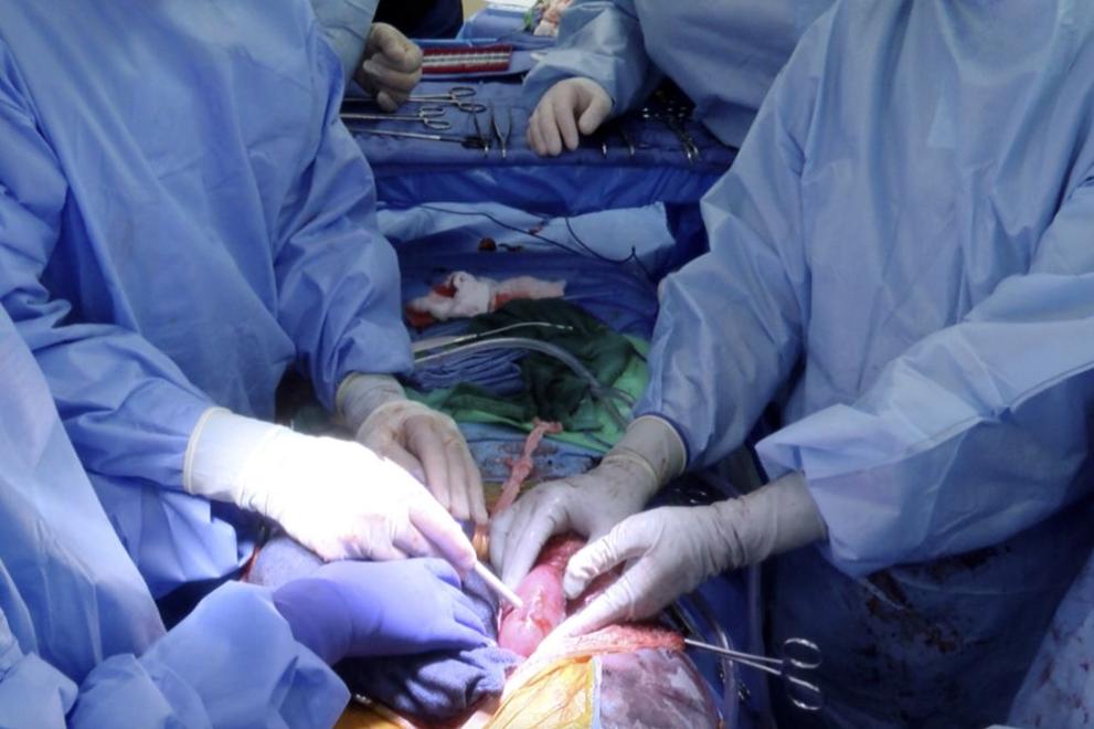 Свински бъбрек, трансплантиран на човек в мозъчна смърт в САЩ,