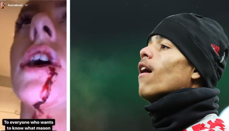 Мейсън Гринууд - Разследват играч на Ман Юнайтед за брутален кървав побой над приятелката му