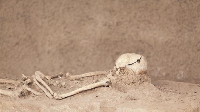 Древен хирургически имплант озадачава учените 