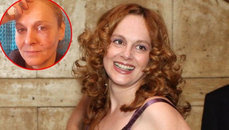 актриса - УЖАСЕН ИНЦИДЕНТ: Актриса си разби лицето в тъмното