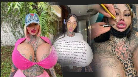 пластични операции