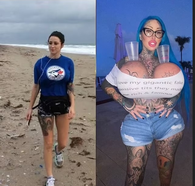 пластични операции