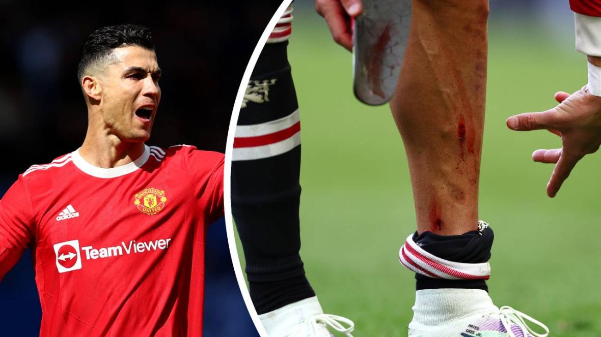 Роналдо Евертън