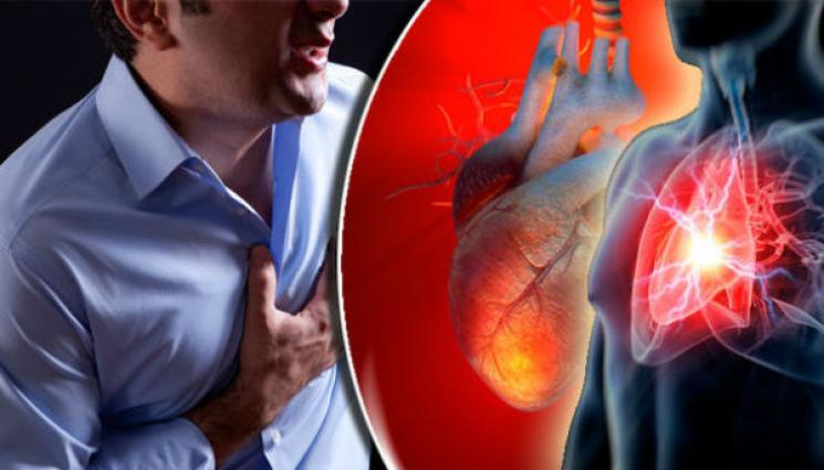 инфаркт - Скок на инфаркти и инсулти