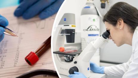 кръвна картина лаборатория изследвания