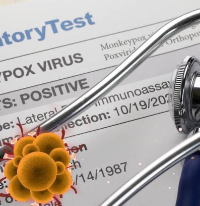 Маймунска шарка