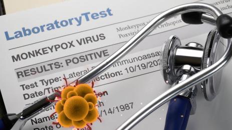 Маймунска шарка