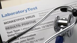 Двамата заболели от маймунска шарка са в добро състояние Това