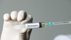 Франция регистрира над 1700 потвърдени случая на маймунска шарка Това