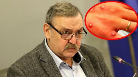 Кантарджиев маймунска шарка