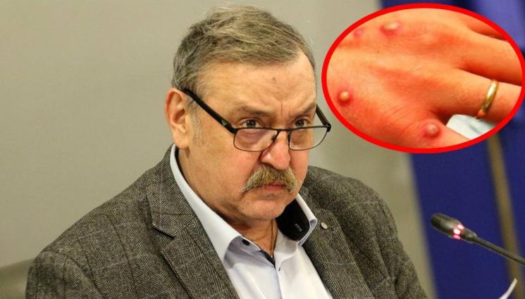 Кантарджиев маймунска шарка - НОВОТО ЗЛО: Имаме тестове за маймунска шарка