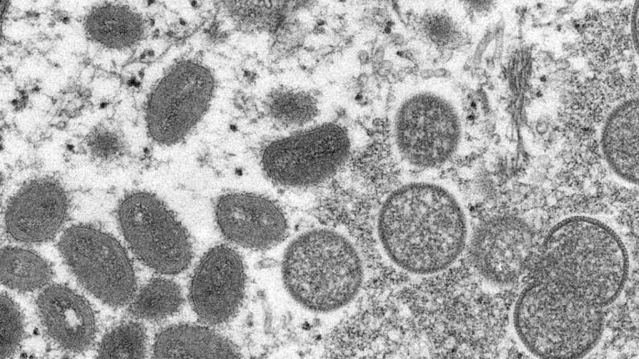 Вирусът на маймунската шарка мутира по-бързо от очакванията