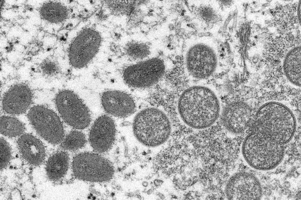 Вирусът на маймунската шарка е открит през 1959 г. при огнище на подобно на шарка заболяване сред маймуни, отглеждани в изследователски институт в Копенхаген, Дания.  Тази история дава наименованието му, но вирусът засяга и други животни, основно гризачи.