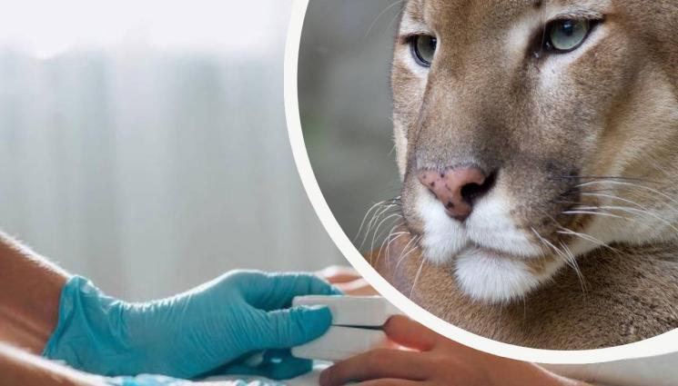 пума дете - ЧУДО! Пума нападна дете, то оцеля