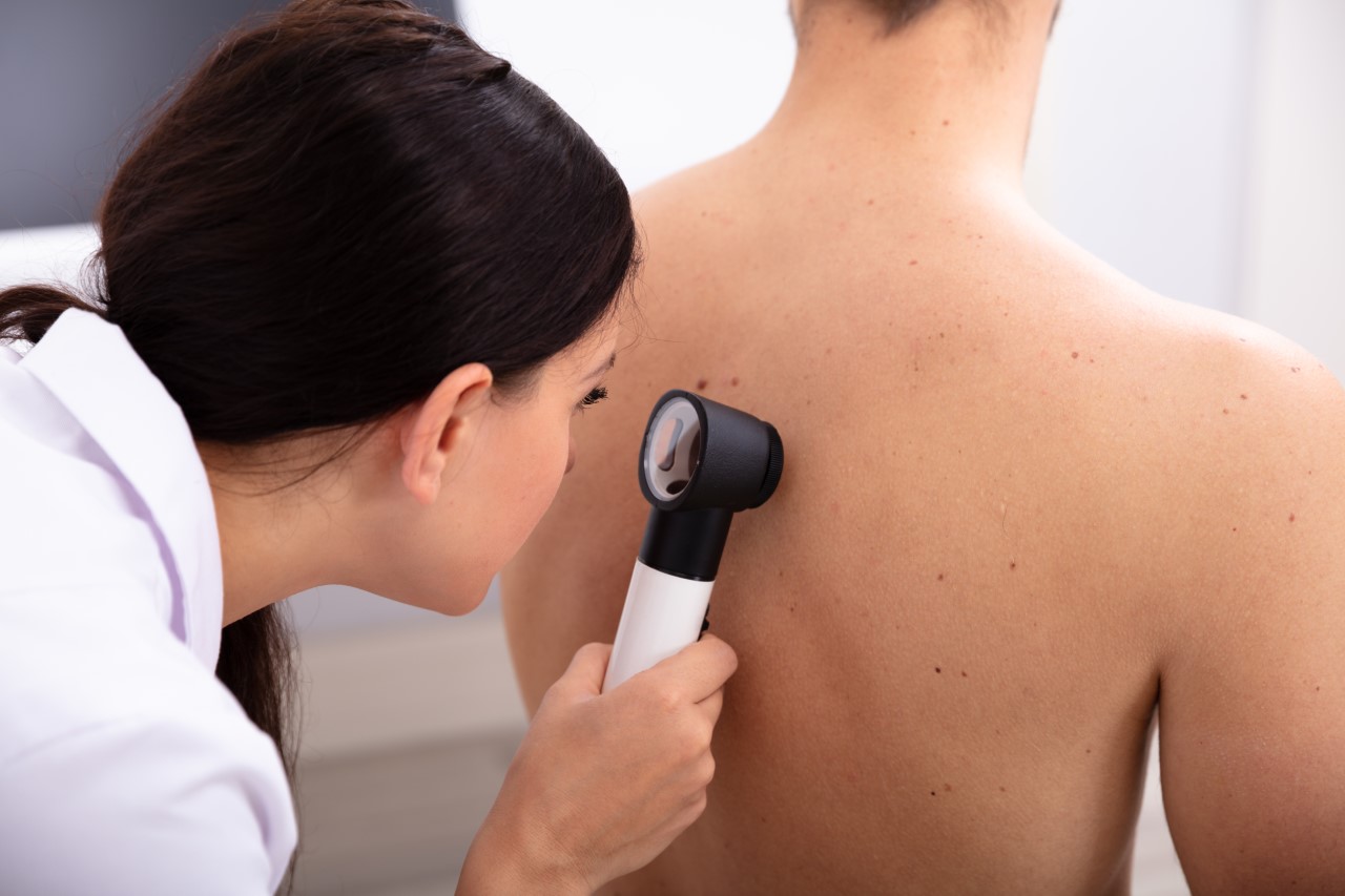 <p>Диагностика на кожата: Мъжете с фамилна анамнеза за рак на кожата или които са имали значителни слънчеви изгаряния, когато са били по-млади, са изложени на висок риск от рак на кожата. Шлахтер казва, че ракът на кожата може да засегне мъже на всяка възраст. &bdquo;Много е важно да се правят годишни прегледи на кожата от дерматолог. Вкъщи мъжете трябва да следят внимателно бенките и рождените си белези, тъй като леки промени могат да означават, че има проблем&ldquo;, каза тя. &quot;Използването на слънцезащитен крем е от голямо значение.&quot;</p>