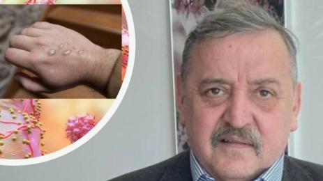 кантарджиев маймунска шарка