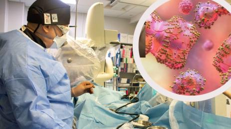 маймунска шарка