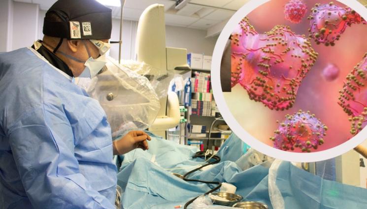 маймунска шарка - ИЗЛЕКУВАНИ: Изписаха двамата пациенти с маймунска шарка