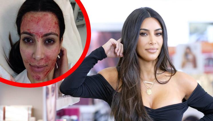 Кардашиян - ИСКРЕНО И ЛИЧНО: Кардашиян сподели къде е играл скалпелът