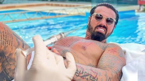 Благой Георгиев Благо Джизъса ботокс корекции